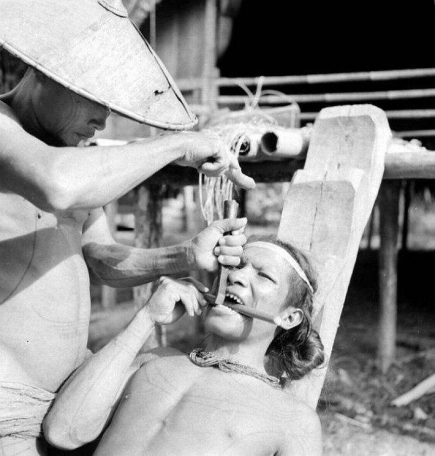 Точіння зубів у племен Індонезії 1938: Давні традиції та звичаї
